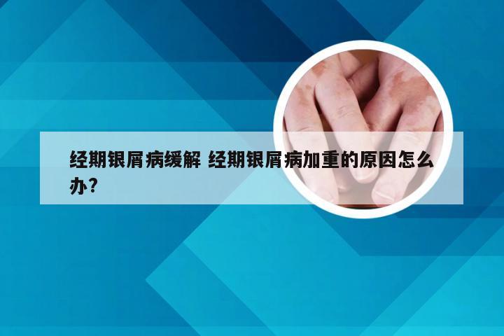经期银屑病缓解 经期银屑病加重的原因怎么办?
