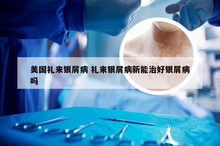 美国礼来银屑病 礼来银屑病新能治好银屑病吗