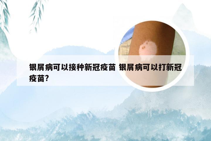 银屑病可以接种新冠疫苗 银屑病可以打新冠疫苗?