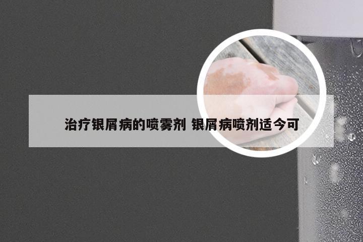 治疗银屑病的喷雾剂 银屑病喷剂适今可