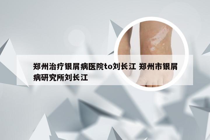 郑州治疗银屑病医院to刘长江 郑州市银屑病研究所刘长江