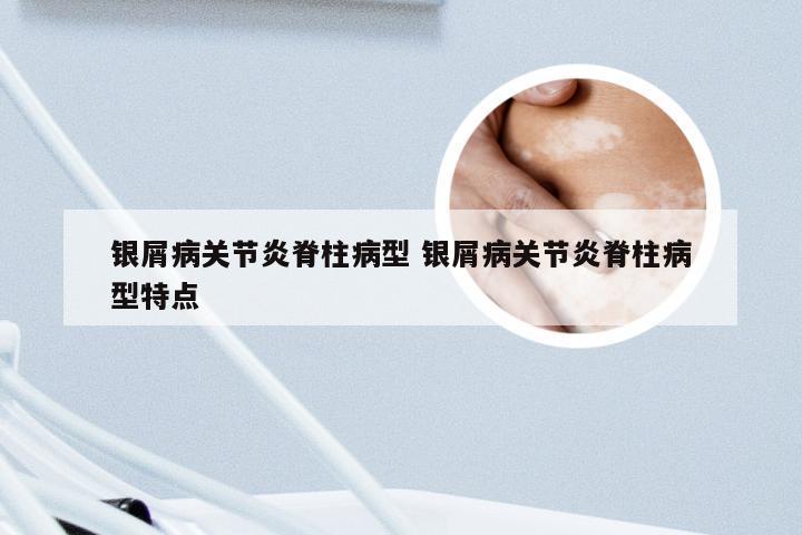 银屑病关节炎脊柱病型 银屑病关节炎脊柱病型特点