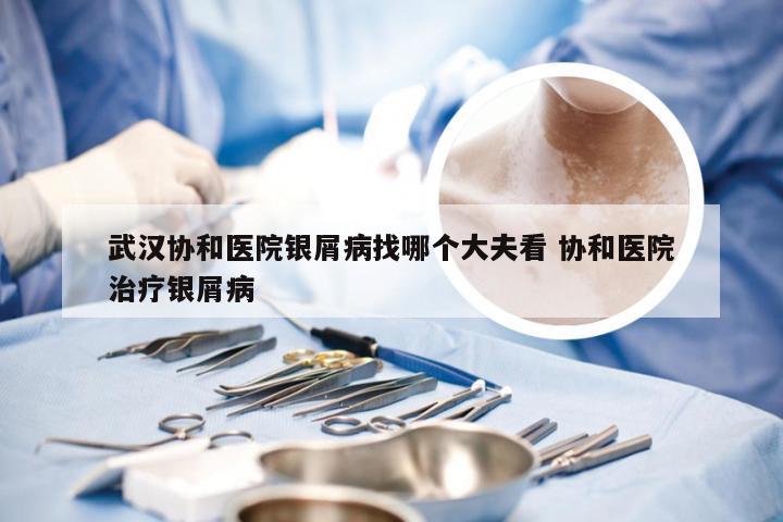 武汉协和医院银屑病找哪个大夫看 协和医院治疗银屑病
