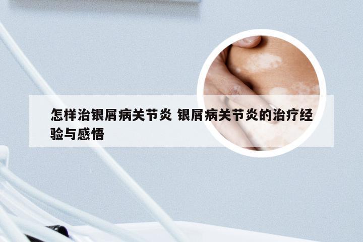 怎样治银屑病关节炎 银屑病关节炎的治疗经验与感悟