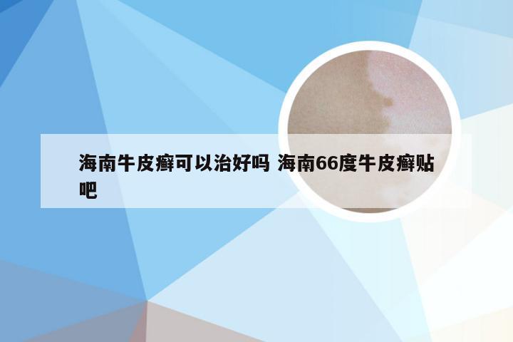 海南牛皮癣可以治好吗 海南66度牛皮癣贴吧