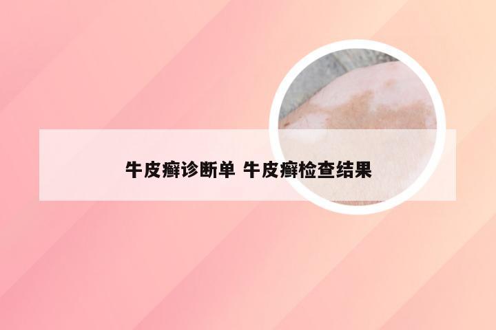 牛皮癣诊断单 牛皮癣检查结果