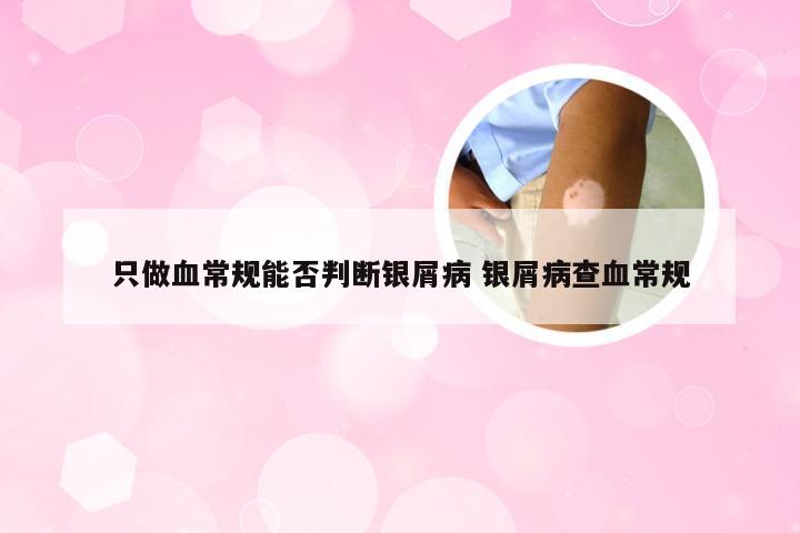 只做血常规能否判断银屑病 银屑病查血常规