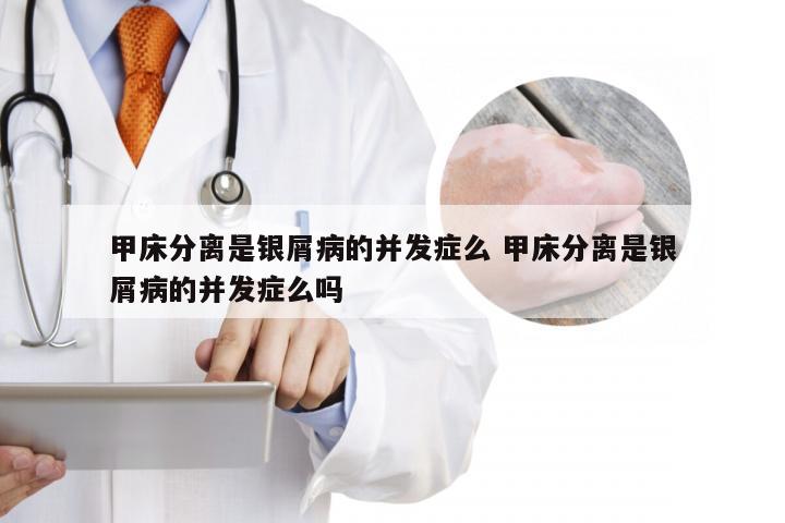 甲床分离是银屑病的并发症么 甲床分离是银屑病的并发症么吗