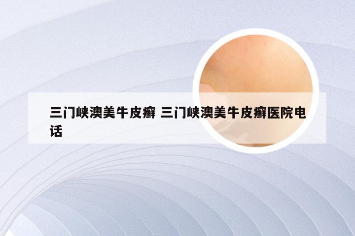 三门峡澳美牛皮癣 三门峡澳美牛皮癣医院电话