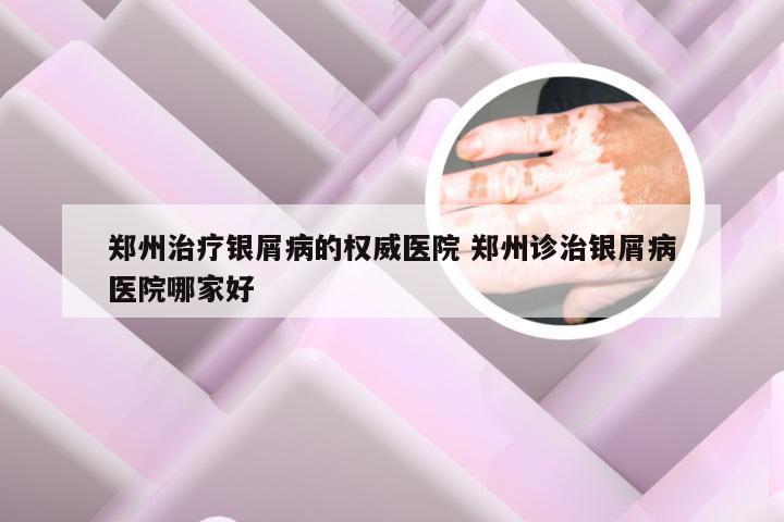 郑州治疗银屑病的权威医院 郑州诊治银屑病医院哪家好