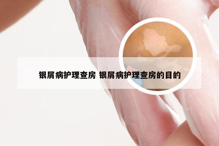 银屑病护理查房 银屑病护理查房的目的