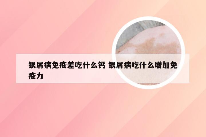 银屑病免疫差吃什么钙 银屑病吃什么增加免疫力