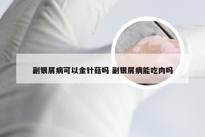 副银屑病可以金针菇吗 副银屑病能吃肉吗