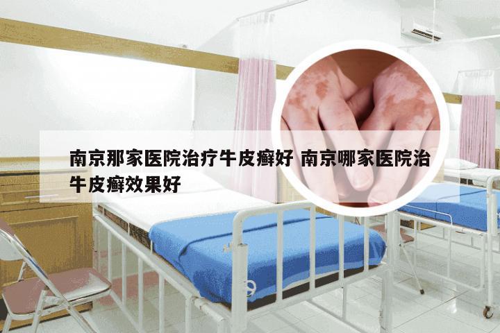 南京那家医院治疗牛皮癣好 南京哪家医院治牛皮癣效果好