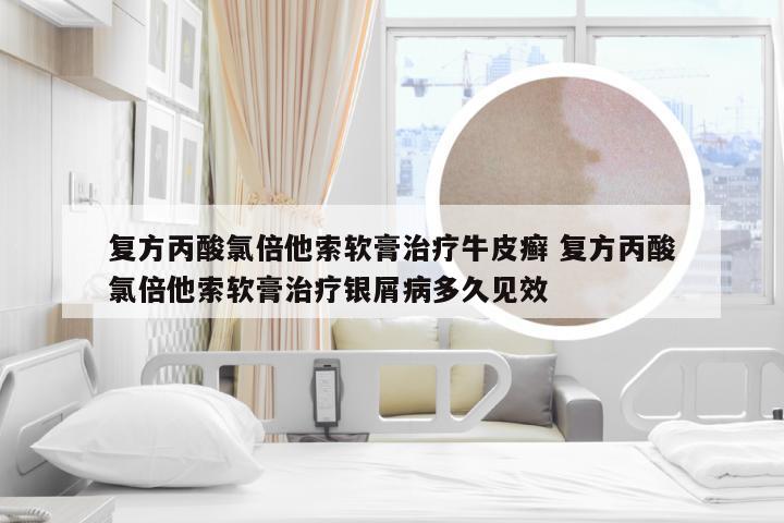 复方丙酸氯倍他索软膏治疗牛皮癣 复方丙酸氯倍他索软膏治疗银屑病多久见效