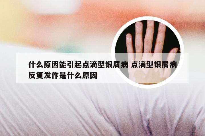 什么原因能引起点滴型银屑病 点滴型银屑病反复发作是什么原因