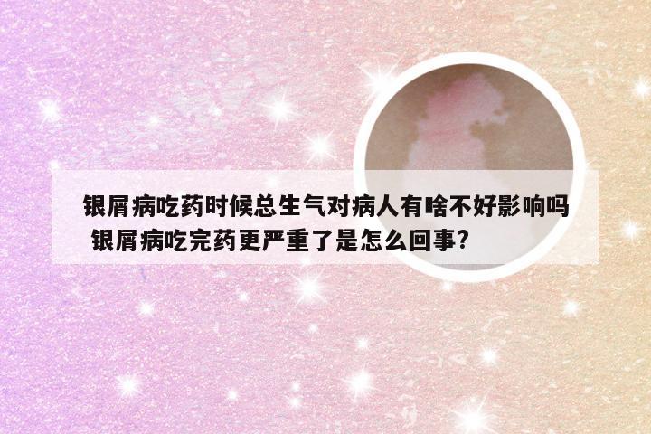 银屑病吃药时候总生气对病人有啥不好影响吗 银屑病吃完药更严重了是怎么回事?
