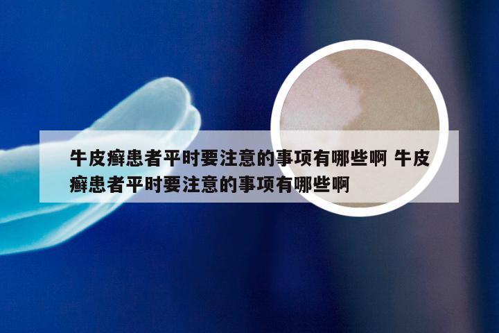 牛皮癣患者平时要注意的事项有哪些啊 牛皮癣患者平时要注意的事项有哪些啊