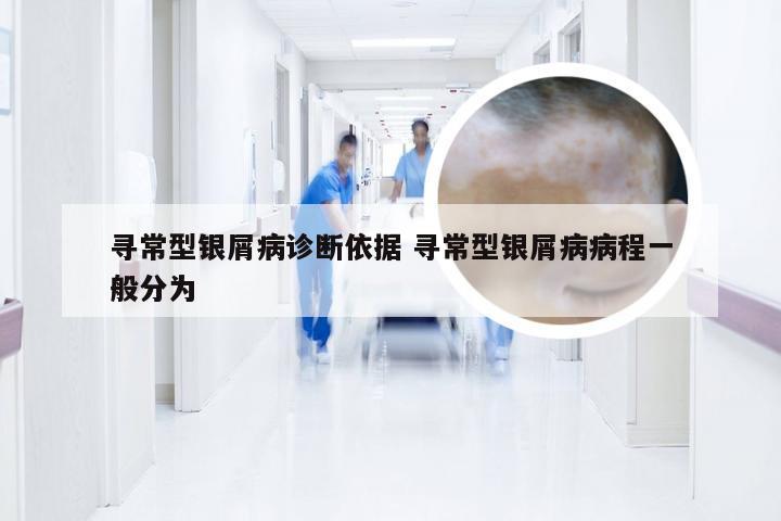 寻常型银屑病诊断依据 寻常型银屑病病程一般分为