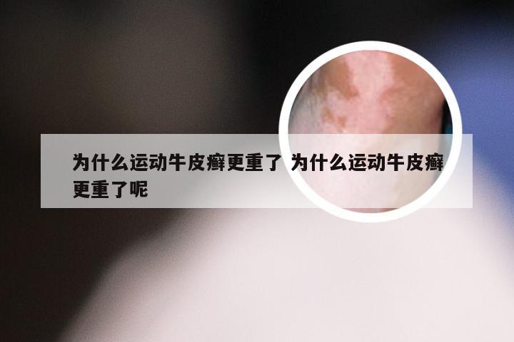 为什么运动牛皮癣更重了 为什么运动牛皮癣更重了呢