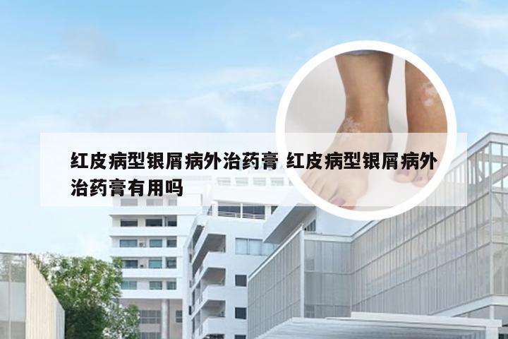 红皮病型银屑病外治药膏 红皮病型银屑病外治药膏有用吗