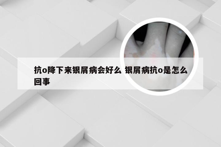 抗o降下来银屑病会好么 银屑病抗o是怎么回事