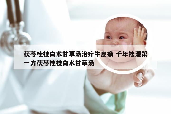 茯苓桂枝白术甘草汤治疗牛皮癣 千年祛湿第一方茯苓桂枝白术甘草汤