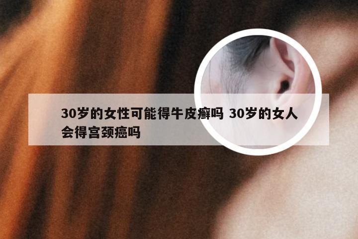 30岁的女性可能得牛皮癣吗 30岁的女人会得宫颈癌吗