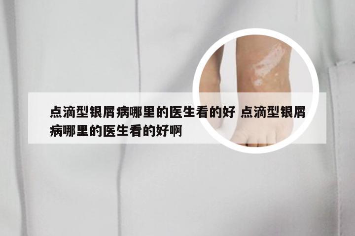 点滴型银屑病哪里的医生看的好 点滴型银屑病哪里的医生看的好啊