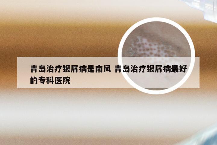 青岛治疗银屑病是南风 青岛治疗银屑病最好的专科医院
