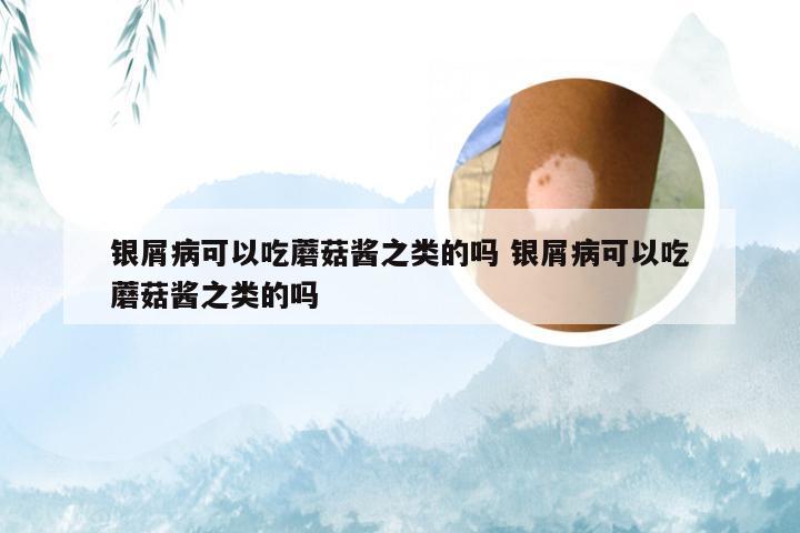 银屑病可以吃蘑菇酱之类的吗 银屑病可以吃蘑菇酱之类的吗