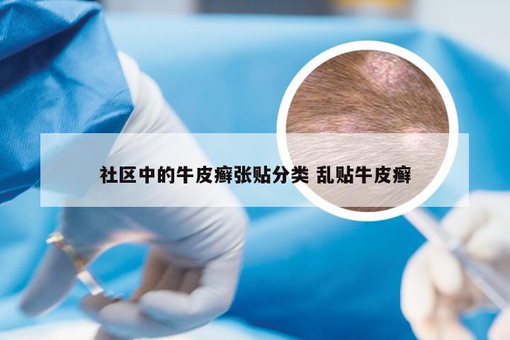 社区中的牛皮癣张贴分类 乱贴牛皮癣