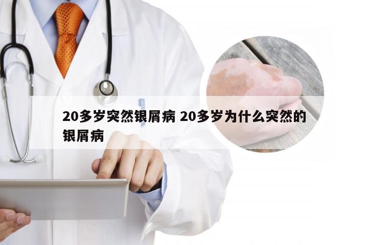 20多岁突然银屑病 20多岁为什么突然的银屑病
