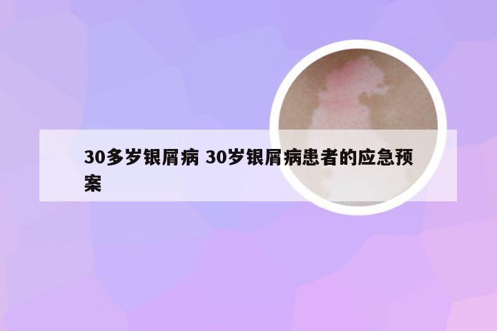 30多岁银屑病 30岁银屑病患者的应急预案