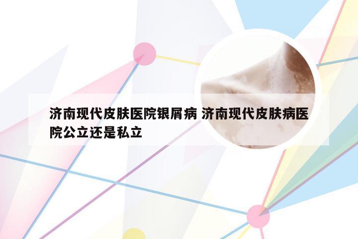 济南现代皮肤医院银屑病 济南现代皮肤病医院公立还是私立