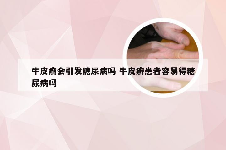 牛皮癣会引发糖尿病吗 牛皮癣患者容易得糖尿病吗