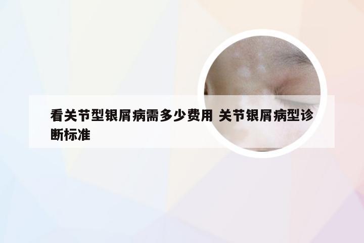 看关节型银屑病需多少费用 关节银屑病型诊断标准