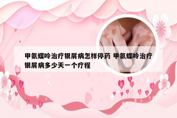 甲氨蝶呤治疗银屑病怎样停药 甲氨蝶呤治疗银屑病多少天一个疗程