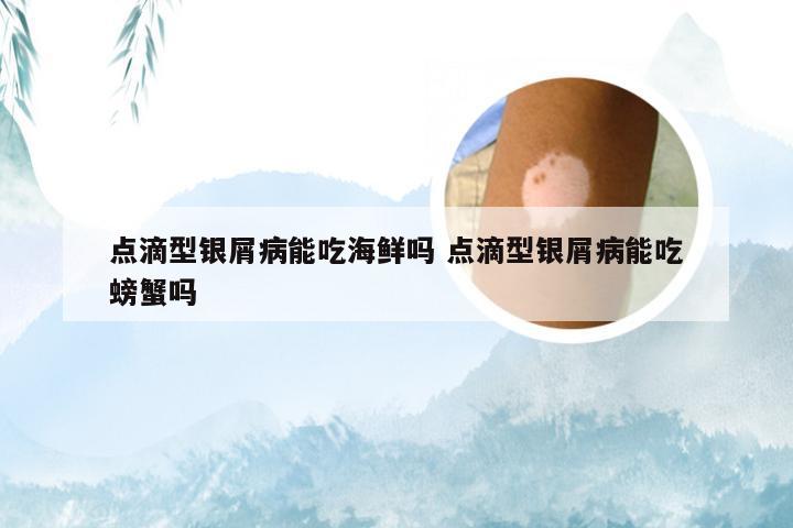 点滴型银屑病能吃海鲜吗 点滴型银屑病能吃螃蟹吗