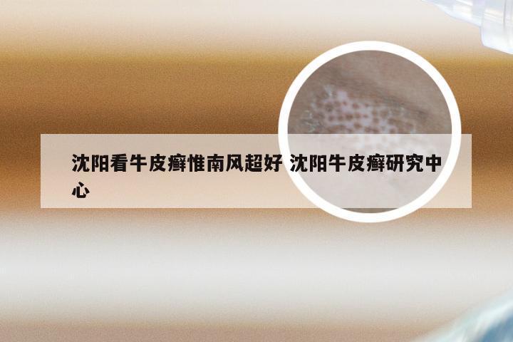 沈阳看牛皮癣惟南风超好 沈阳牛皮癣研究中心