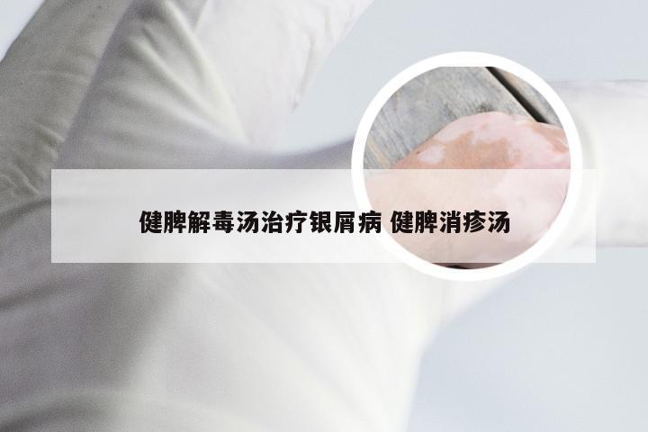 健脾解毒汤治疗银屑病 健脾消疹汤
