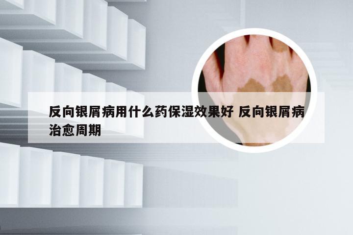 反向银屑病用什么药保湿效果好 反向银屑病治愈周期