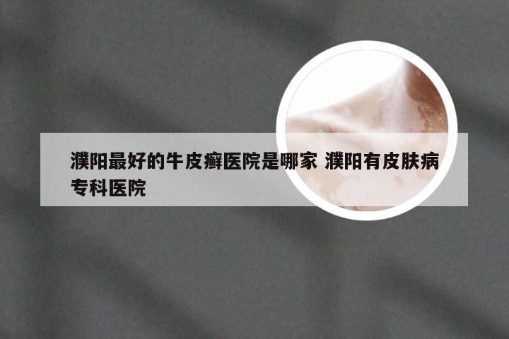 濮阳最好的牛皮癣医院是哪家 濮阳有皮肤病专科医院