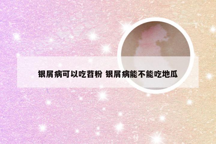 银屑病可以吃苕粉 银屑病能不能吃地瓜