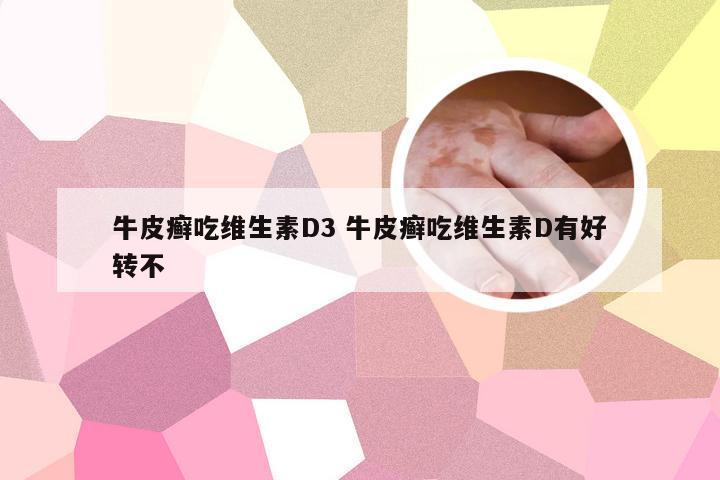 牛皮癣吃维生素D3 牛皮癣吃维生素D有好转不