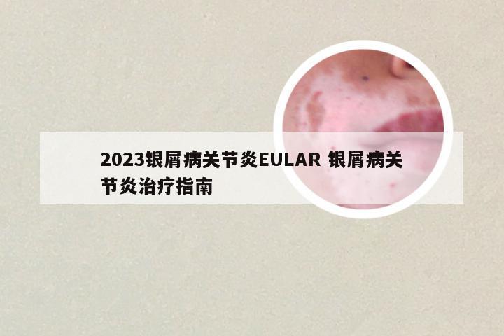 2023银屑病关节炎EULAR 银屑病关节炎治疗指南