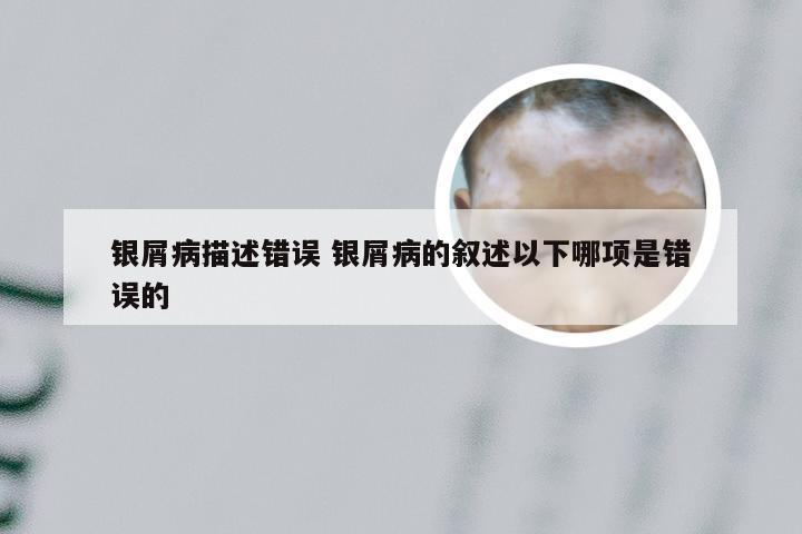 银屑病描述错误 银屑病的叙述以下哪项是错误的