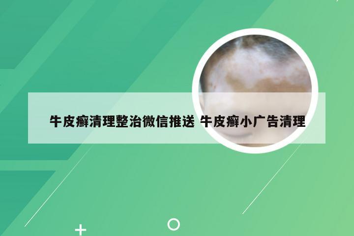 牛皮癣清理整治微信推送 牛皮癣小广告清理