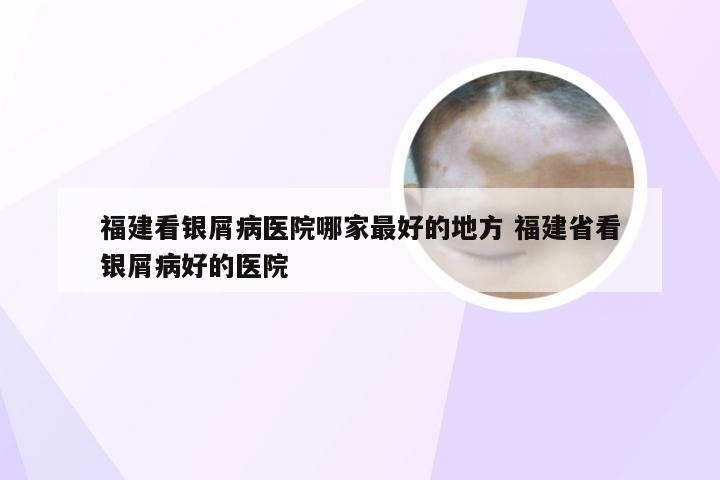 福建看银屑病医院哪家最好的地方 福建省看银屑病好的医院