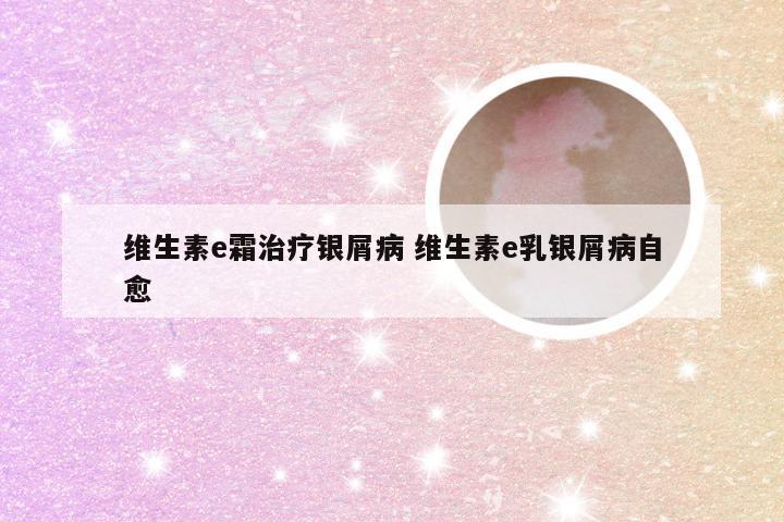 维生素e霜治疗银屑病 维生素e乳银屑病自愈